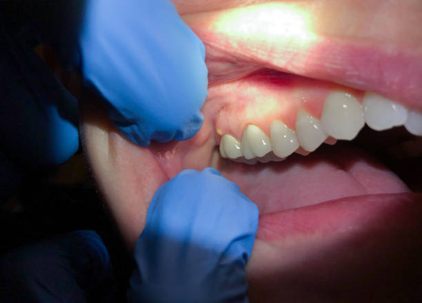 Best Emergency Dental Services for Seniors in Glenn Heights, TX